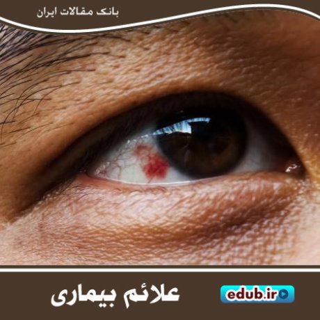 بیماری‌هایی که علائم آن در چشم‌ها ظاهر می‌شوند