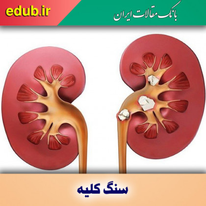 علائم سنگ کلیه