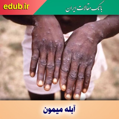 آیا من در معرض خطر ابتلا به آبله میمون هستم؟