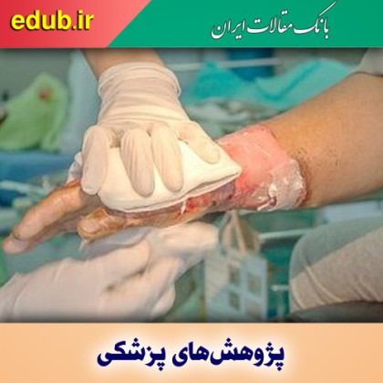 تولید یک پانسمان موثر برای درمان سوختگی در کودکان