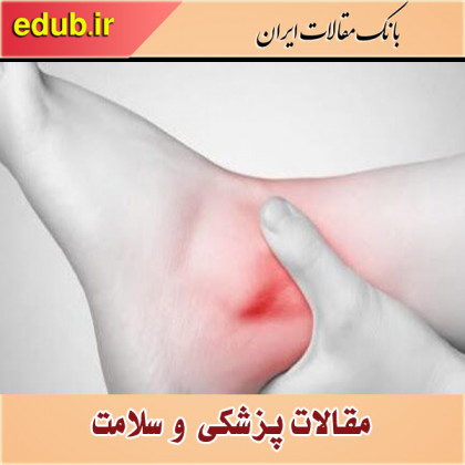 رگ‌های واریسی دارید، این باورهای غلط را کنار بگذارید