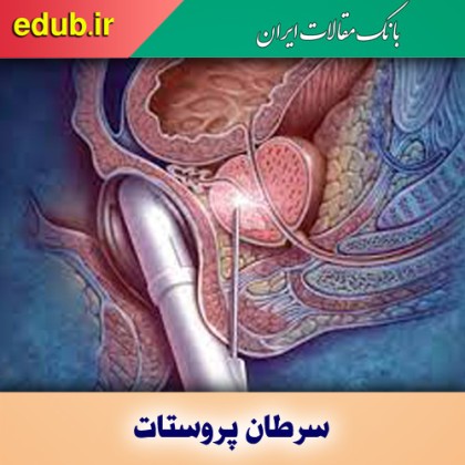 دو عامل افزایش سرطان پروستات