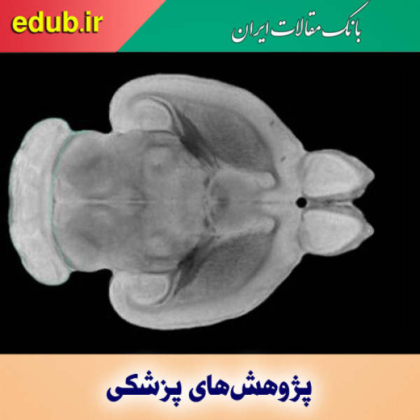 کاهش درد با استفاده از ایمپلنت مغزی