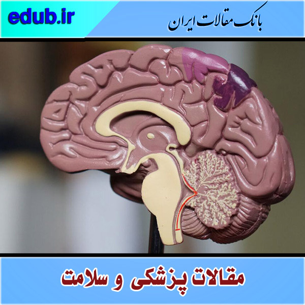 ساخت فرمولاسیون نانویی که آثار سکته مغزی را کاهش می‌دهد