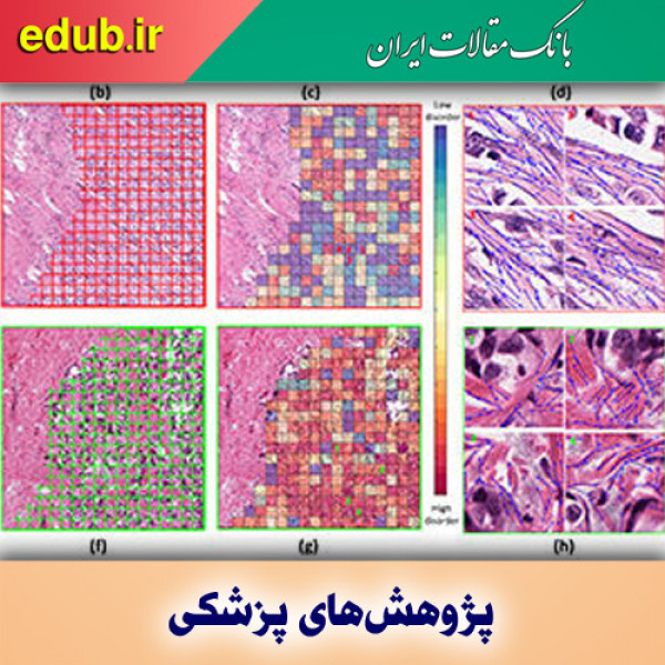 هوش مصنوعی و تشخیص و پیش بینی عود سرطان سینه