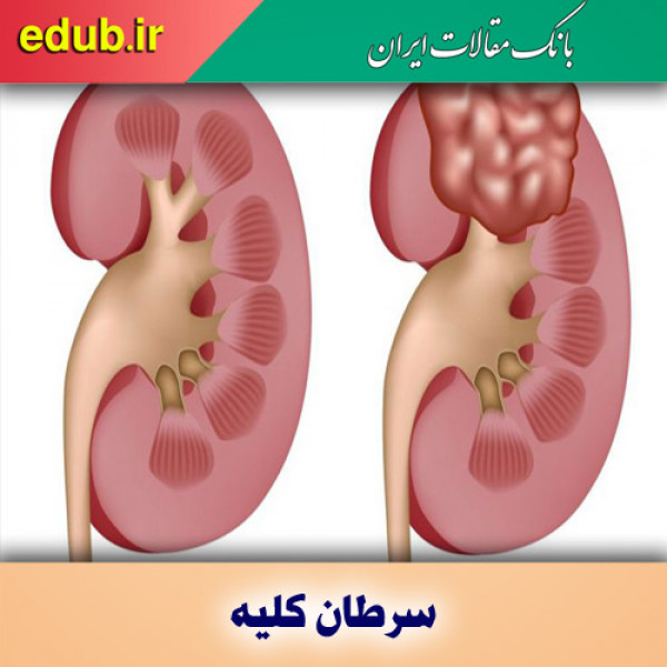 سرطان کلیه شایعترین بیماری کودکان ایران