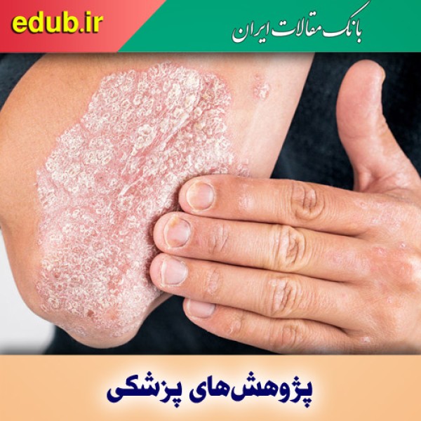 پروتئین‌ها عامل بیماری پسوریازیس