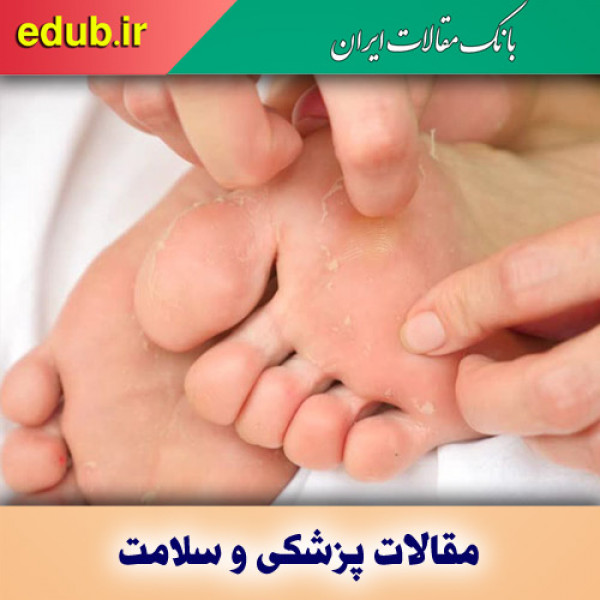 دلایل پوسته پوسته شدن کف پا