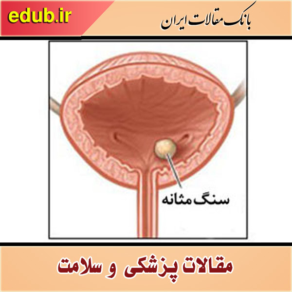 با سنگ مثانه و دلایل ابتلا به آن آشنا شوید