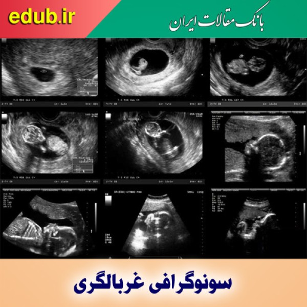 همه چیز درباره سونوگرافی‌های دوران بارداری