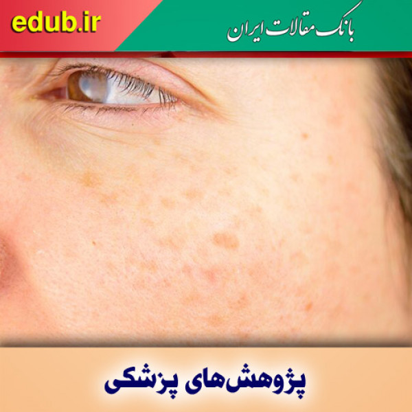 روش‌هایی برای حذف لکه‌های قهوه‌ای ناشی از آفتاب روی پوست