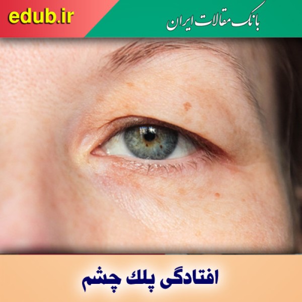 علت افتادگی پلک چشم چیست و چطور درمان می‌شود؟