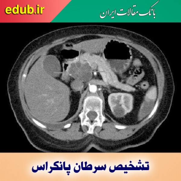 تشخیص سرطان پانکراس با فناوری یادگیری ماشین