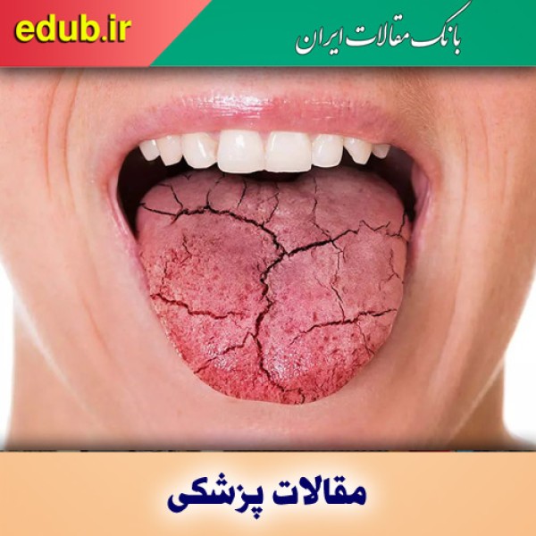 خشکی چشم و دهان نشانه چیست؟