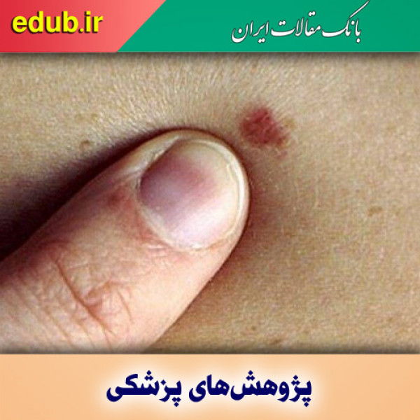 پوست روشن مستعد سرطان است