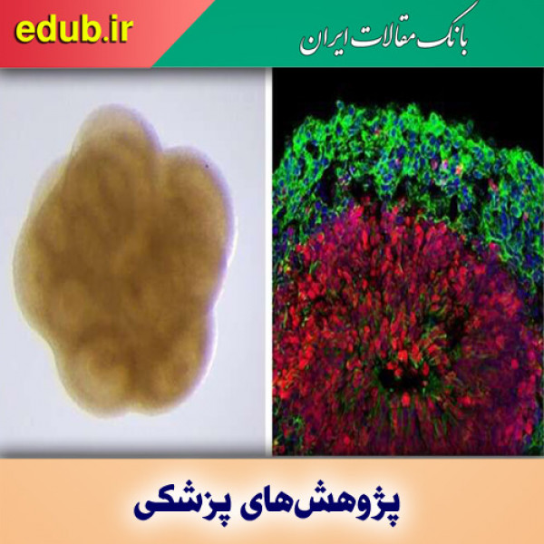 توسعه مغز مینیاتوری برای دستیابی به درمان موثر آلزایمر